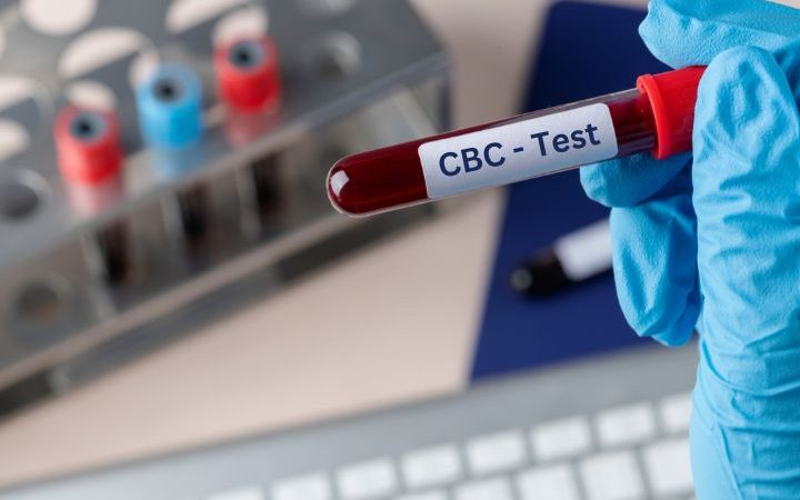 The Role of CBC Tests in Preventive Healthcare: Why It’s Worth the Investment