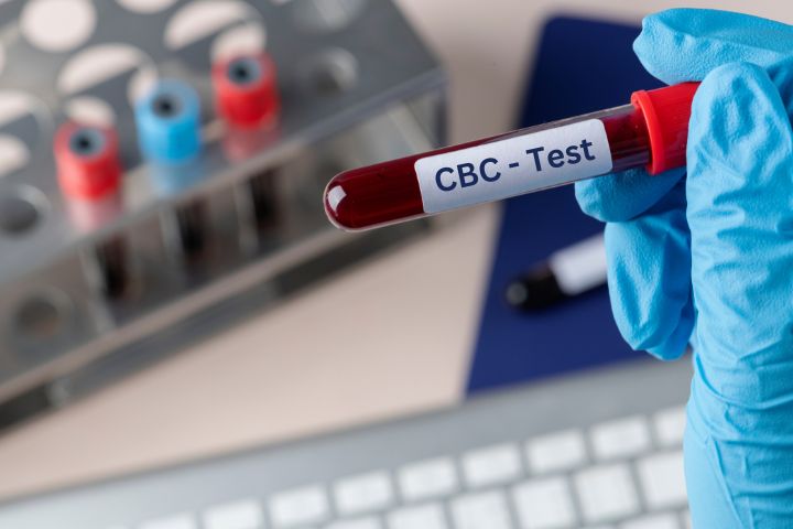 The Role of CBC Tests in Preventive Healthcare: Why It’s Worth the Investment